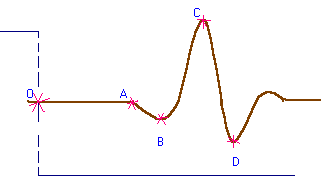 Signal received by the transducer